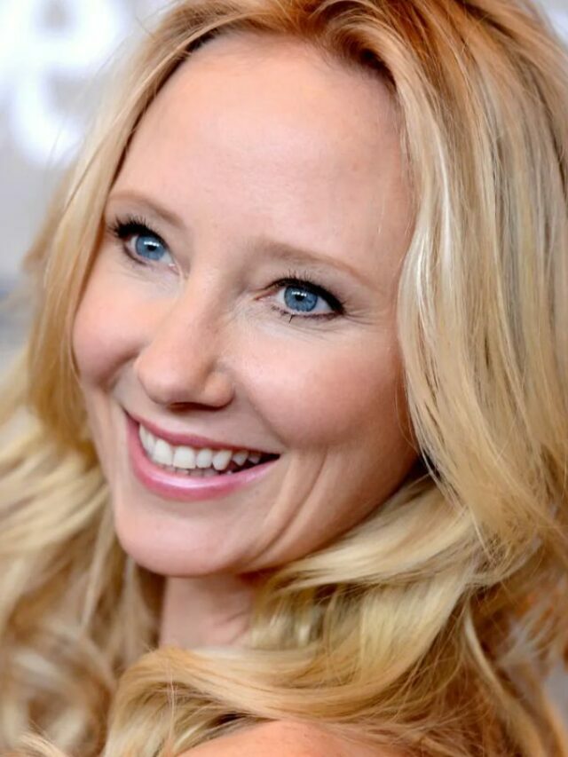 Anne Heche Removed From Life Support After Organs Harvested