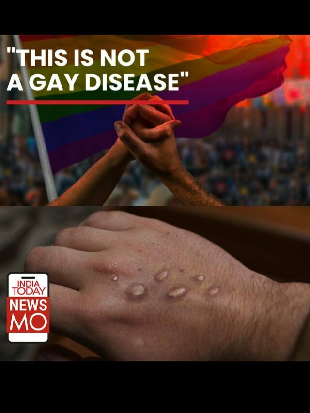 is-monkeypox-a-gay-disease