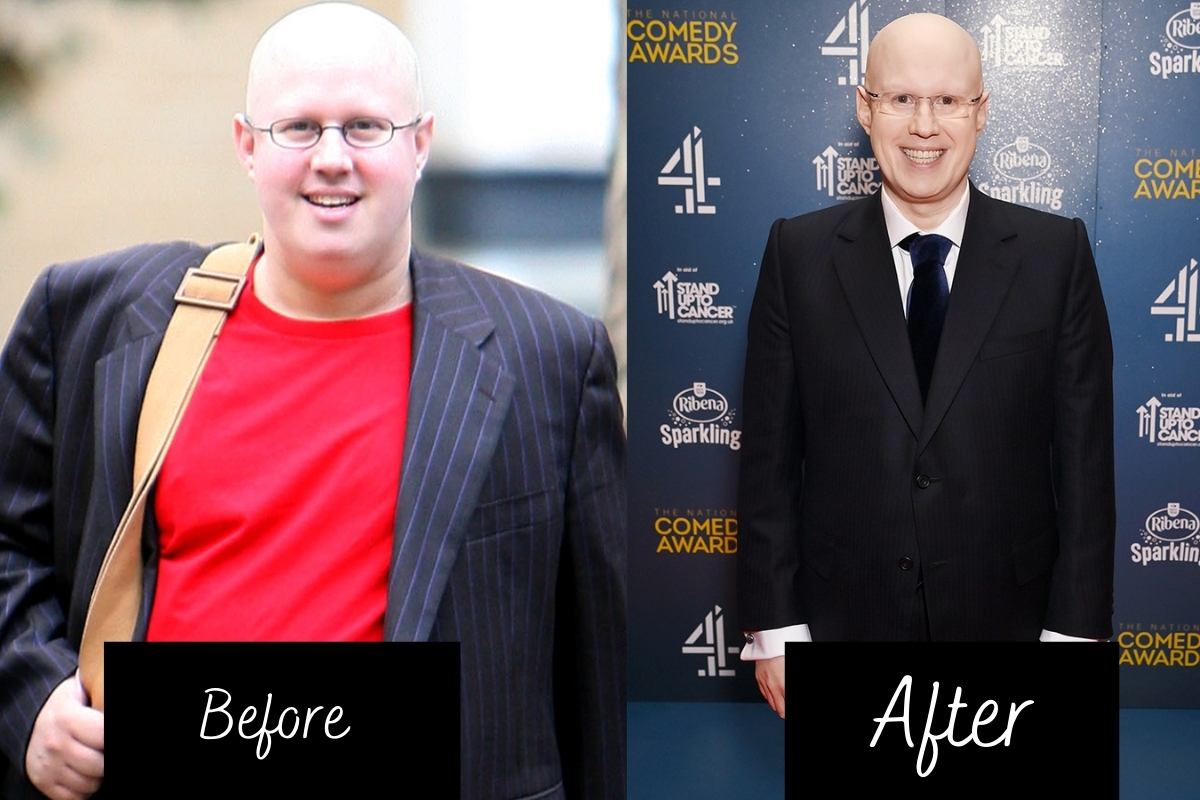 Before and After Weight Loss