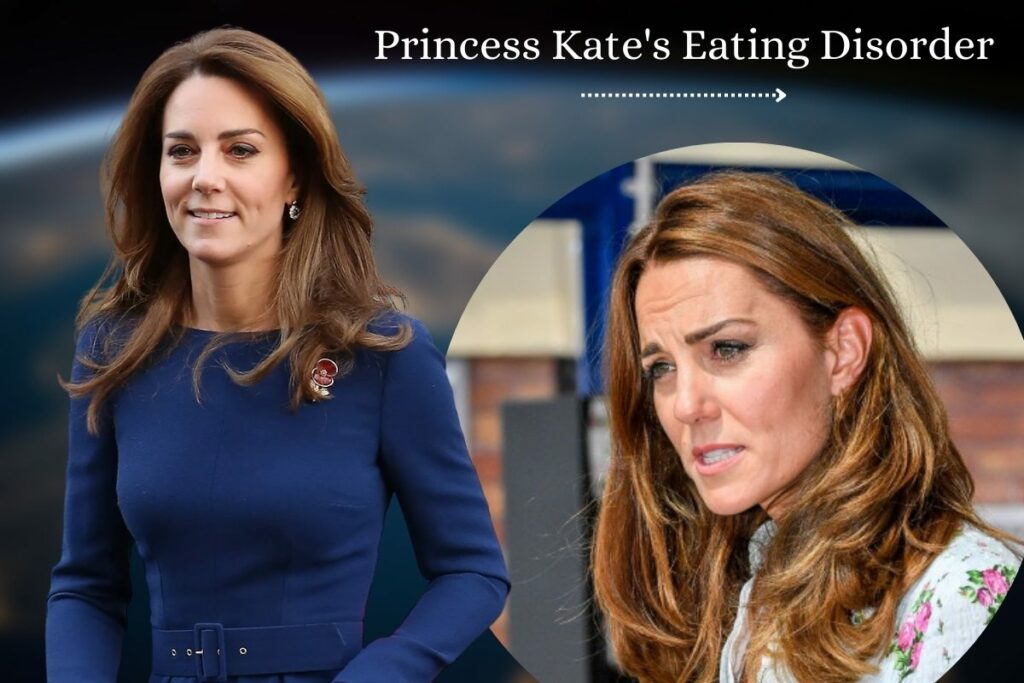 Princess Kate Eating Disorder
