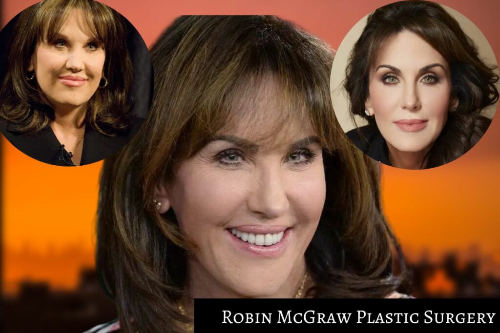 Robin McGraw Plastic Surgery