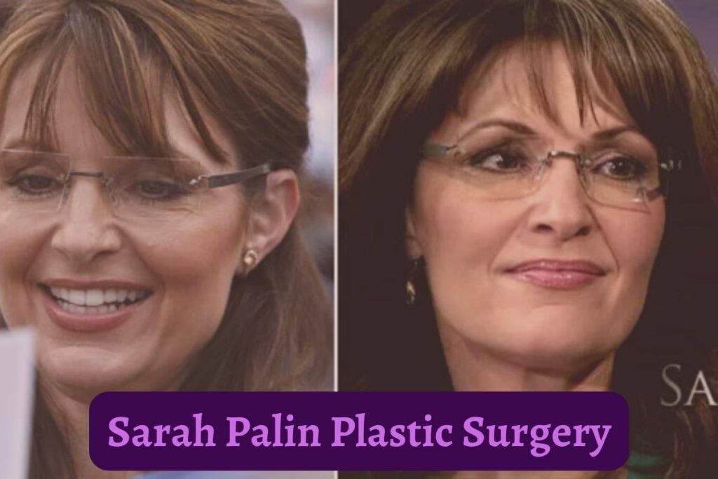 sarah palin plastic surgery
