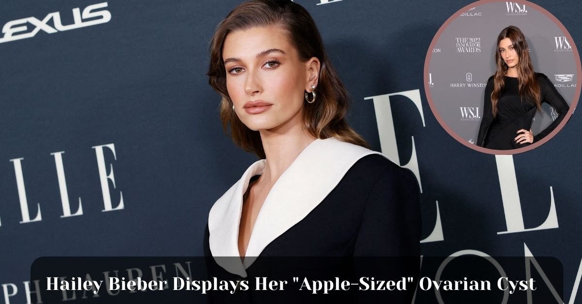 Hailey Bieber Displays Her "Apple-Sized" Ovarian Cyst