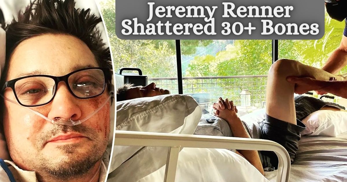 Jeremy Renner Shattered 30+ Bones