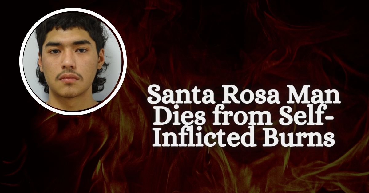 Santa Rosa Man Dies from Self-Inflicted Burns