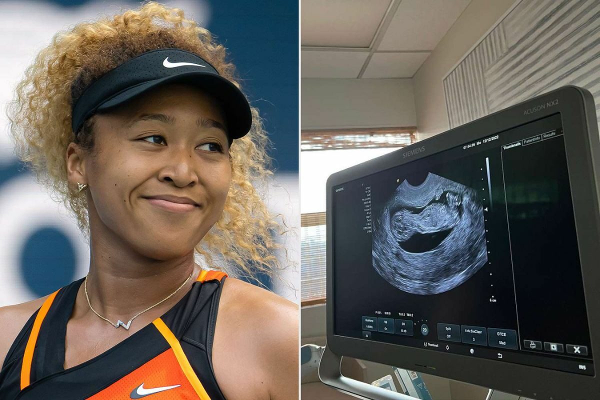 tennis player Naomi pregnant