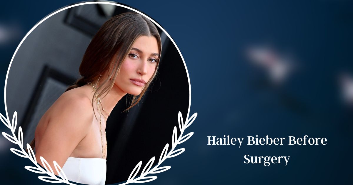 Hailey Bieber Photos Before and After of Her Plastic Surgery