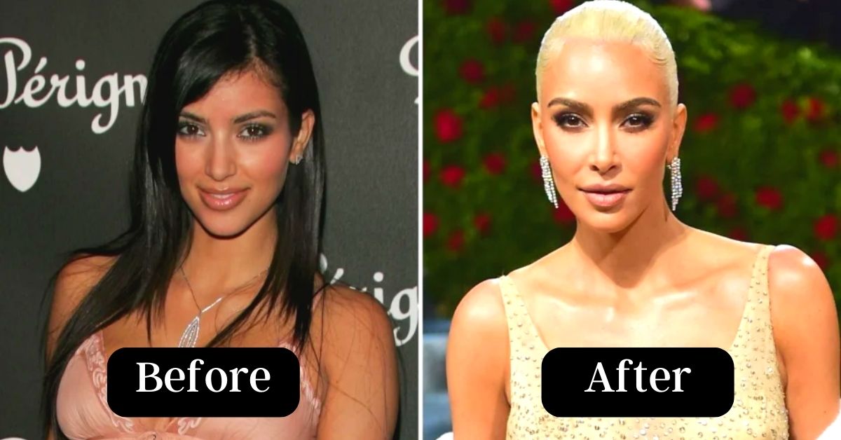 Kim Before Surgery