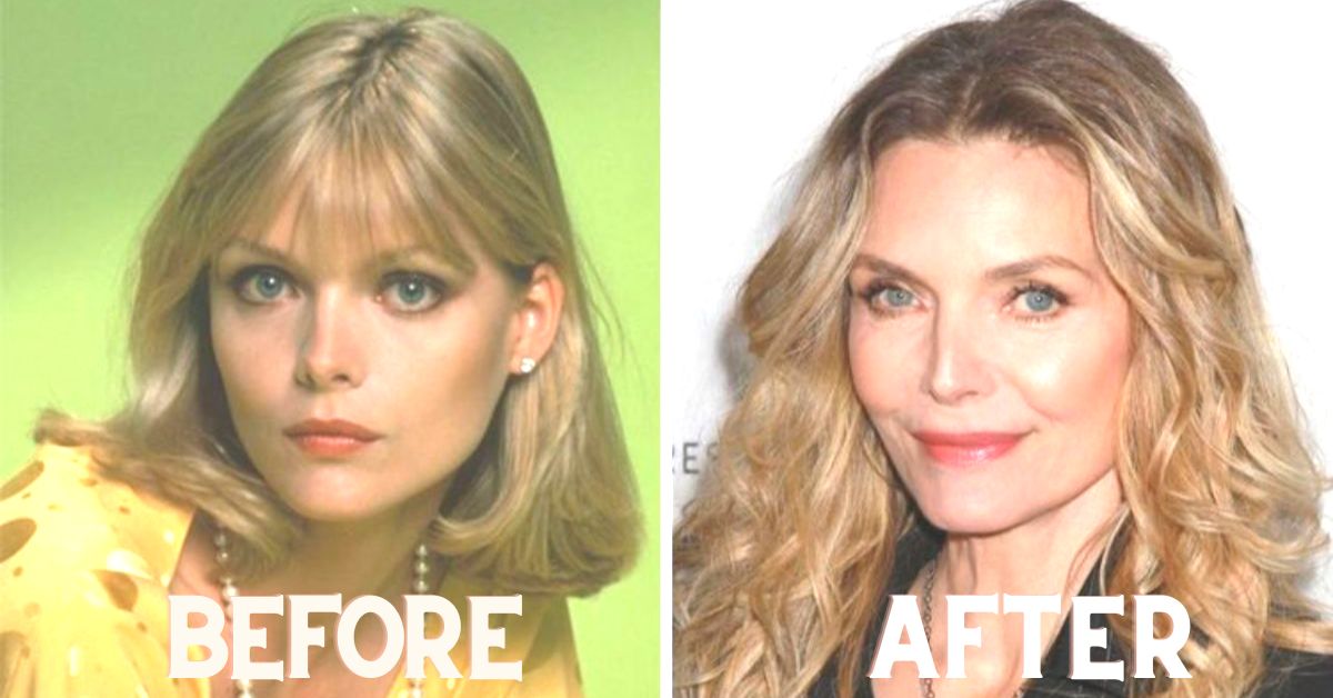 Michelle Pfeiffer plastic surgery