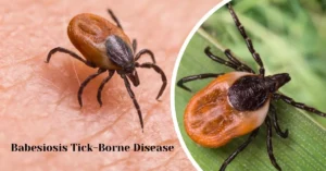 Babesiosis Tick-Borne Disease