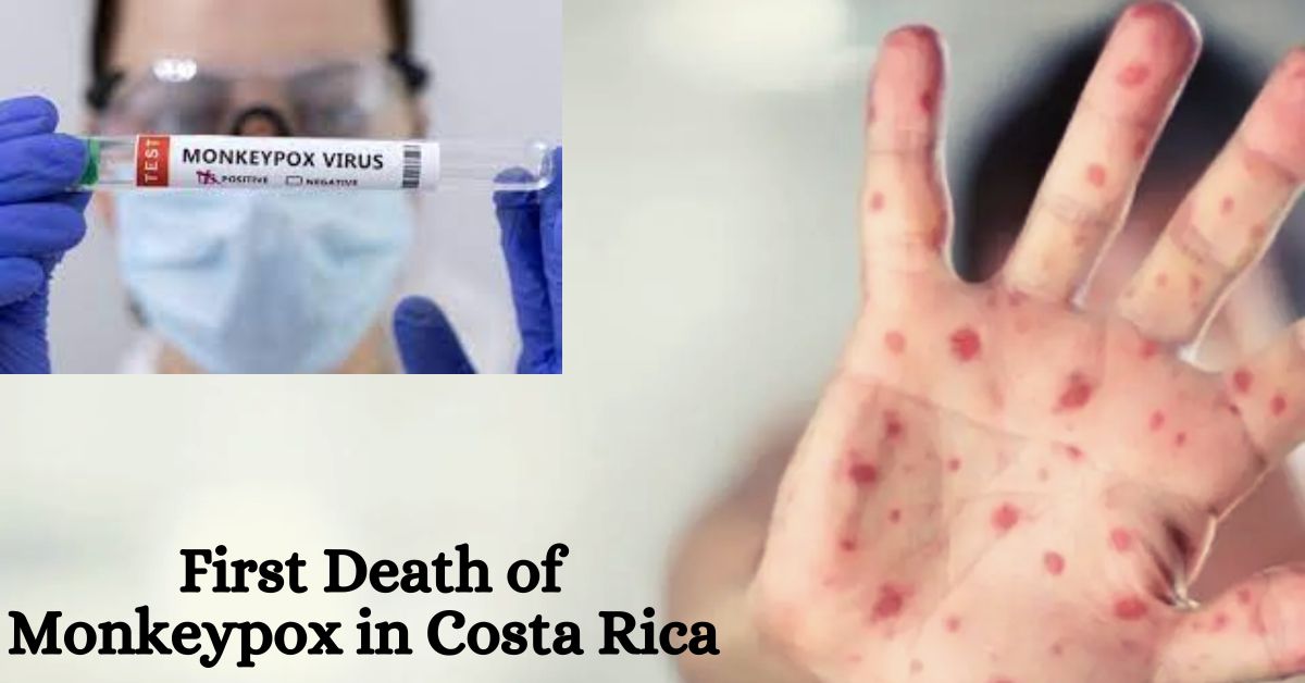 First Death of Monkeypox in Costa Rica