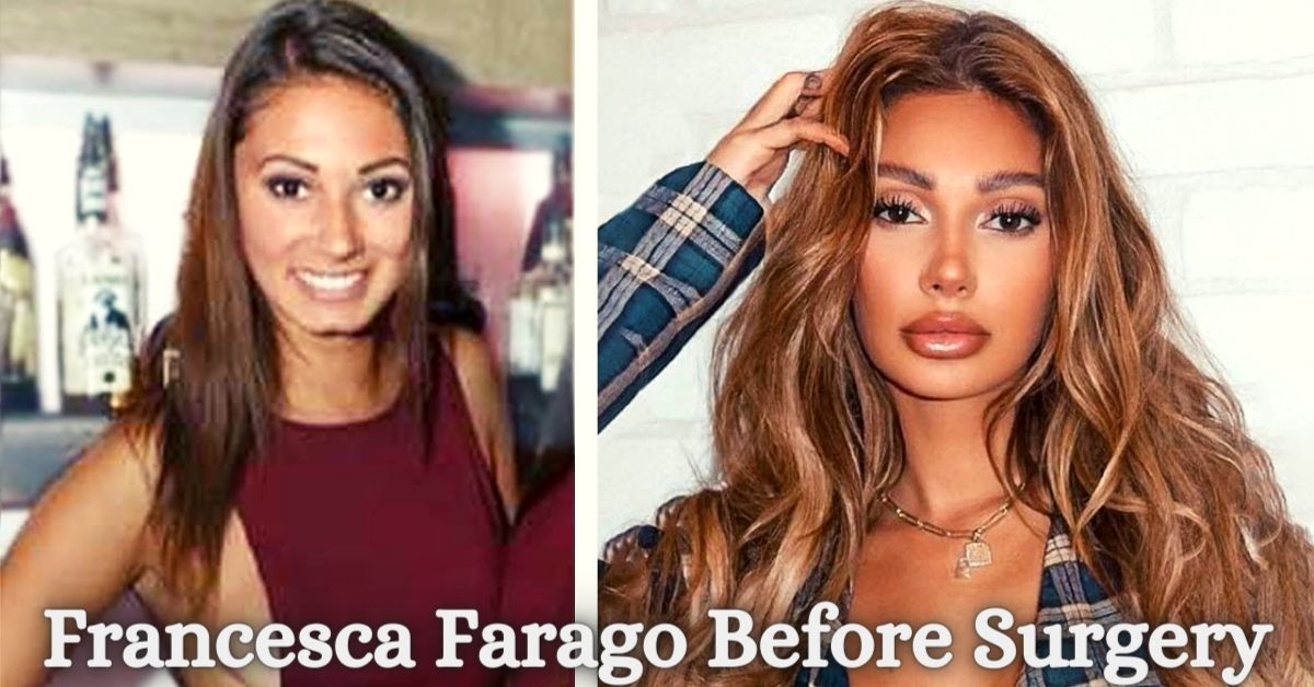 Francesca Farago Before Surgery