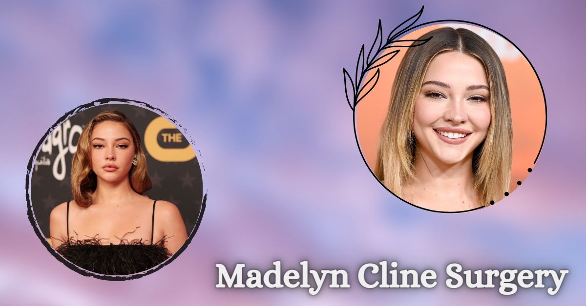 What Did Madelyn Cline Say About Her Surgery Rumors?