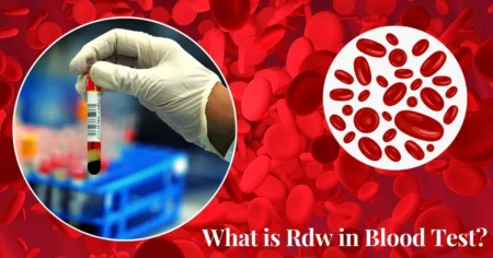 What is Rdw in Blood Test