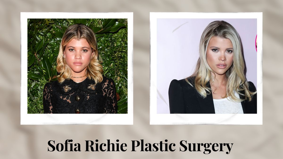 Sofia Richie Plastic Surgery