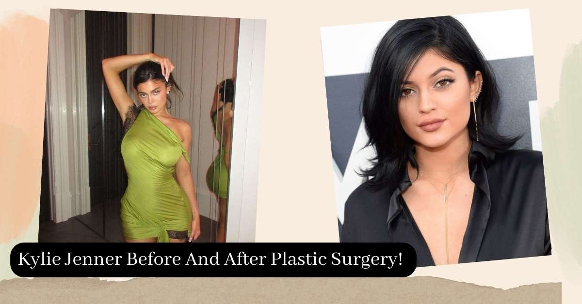Kylie Jenner Before And After Plastic Surgery! Transformation Journey