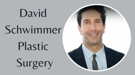David Schwimmer Plastic Surgery