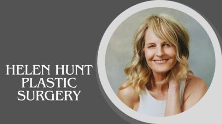 Helen Hunt Plastic Surgery