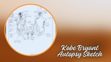 Kobe Bryant Autopsy Sketch