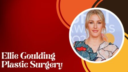 Ellie Goulding Plastic Surgery
